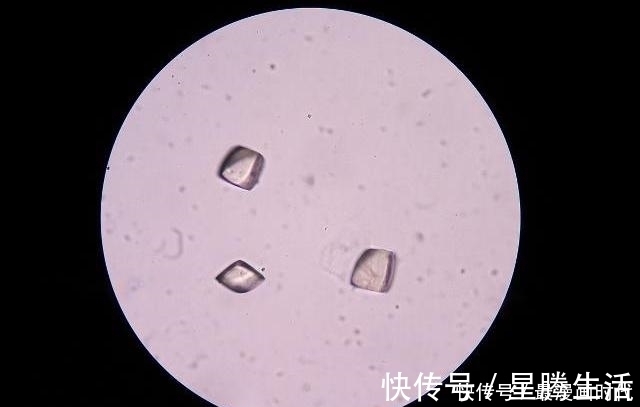 蒲公英|高尿酸患者福音:每天多吃3种食物,有助平衡尿酸,赶走痛风