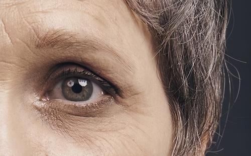 88岁院士，研究皮肤50余年，提醒：少吃2“黄”，皱纹或慢慢减少