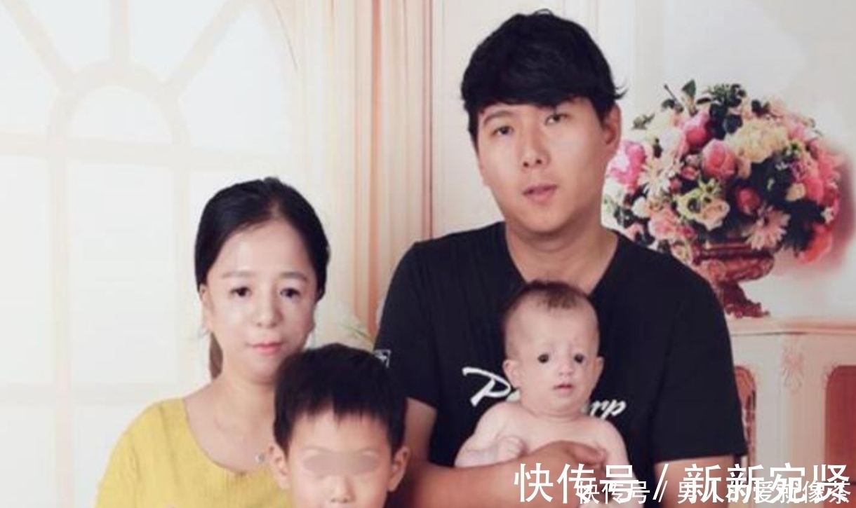 二胎|“鸟脸”妈妈执意生“二胎”,产下孩子容貌引争议,如今后悔了!