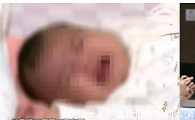 缺乏症|新生儿也会突发脑出血？或因这个“陋习”所致，宝妈们赶紧自查