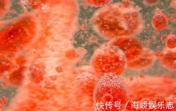 黄色瘤|身体出现4种表现,建议赶紧去查血脂,早发现早治疗