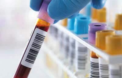 血管堵塞|血管不好,少碰二红,多吃二黑,牢记四句话,血管会越来越好