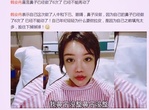 面部|22岁韩安冉面部下垂，多次修复鼻子再无法动刀，越整越像“僵尸脸”