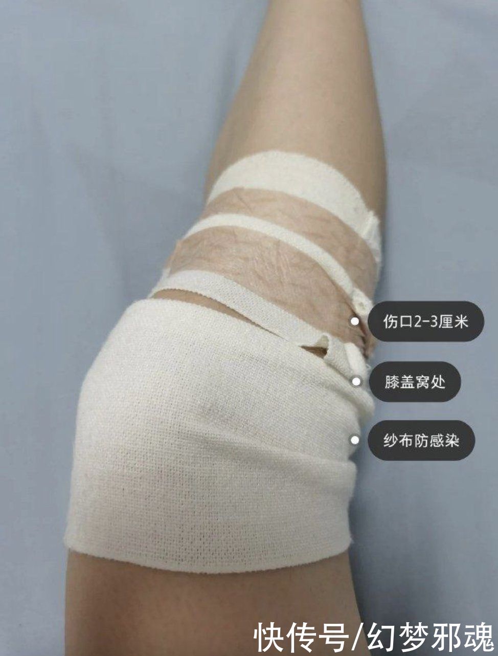 整容|医美乱象：美来自于内心，不在手术刀下？