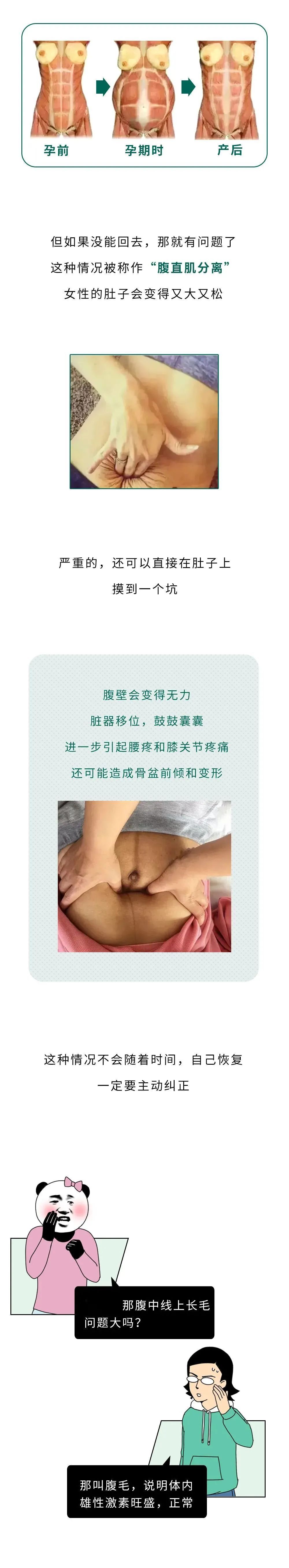 为什么很多女生肚子上有条褐色的竖线？别乱说！不懂先来补课