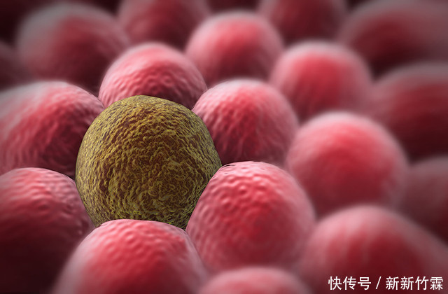 消化科有慢性胃炎,一个“土方”熬水,养好胃,不复发