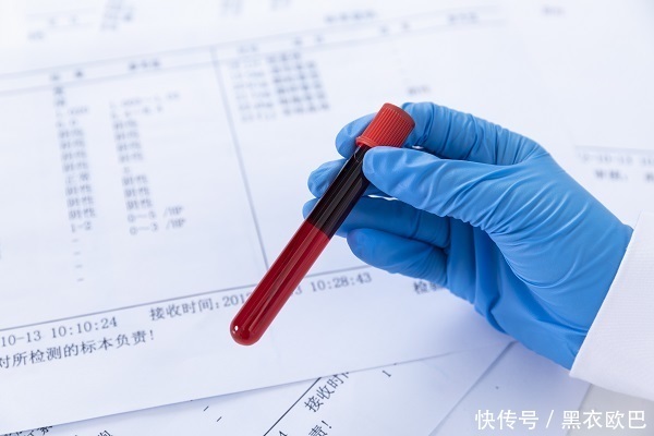 O型血有什么好处5个好处 O型血的男同胞恭喜你 快资讯