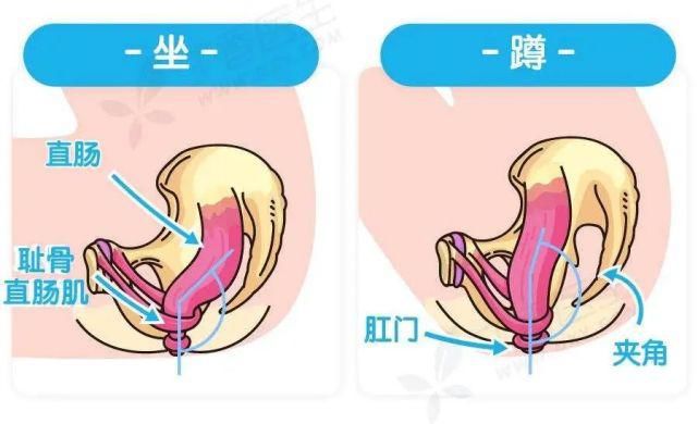  用得上|便秘别只知道吃香蕉！11 个缓解便秘的方法，总有一个用得上