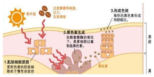 【臣妾做不到系列】皮肤项目的那些硬伤！