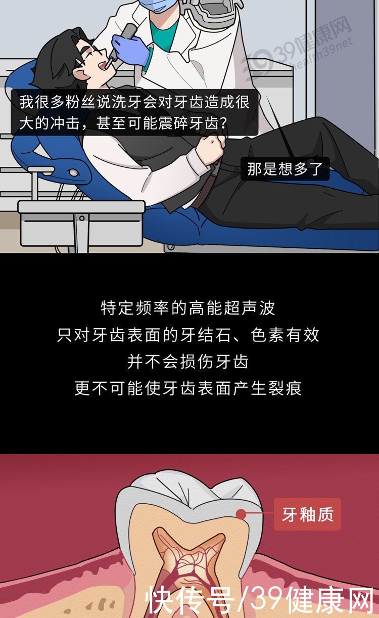 中华|不洗牙，你永远不知道牙齿里面有多脏！看完这篇就拿定主意了