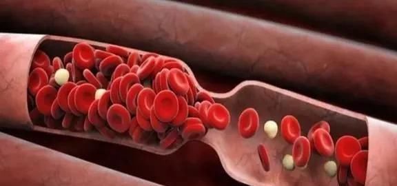 天然“溶栓剂”被发现,不是木耳,每天吃一点,血管咕噜咕噜通了