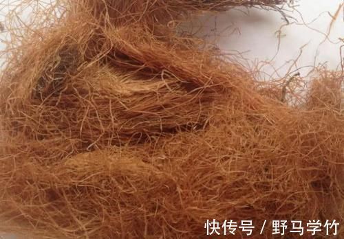 黑蒜|糖尿病的“救星”来了，每天吃一点，稳定血糖，比打胰岛素都强