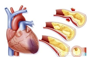 糖尿病足|糖尿病出现这6大表现，证明糖尿病并发症出现，血糖控制不好