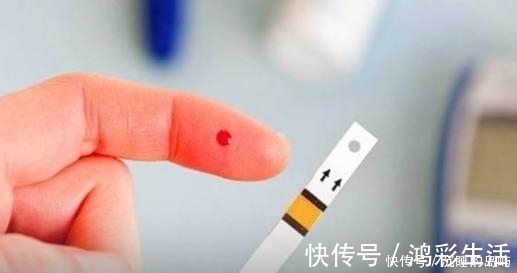 黄鳝鱼|血糖高患者别担心,多吃这3种食物食物,稳定血糖更健康!