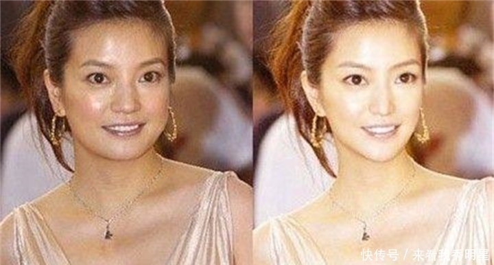 眼是美之窗，鼻是颜之魂；范芳医生谈国人常见鼻型及美学特点一