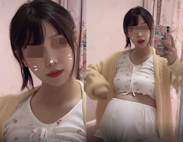 小丽|怀孕后,为啥有人会长妊娠纹,有人却不会长和这四个因素有关