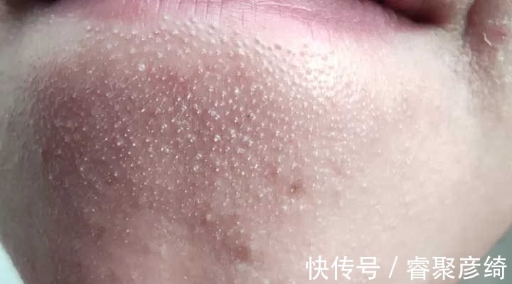 洗脸|为什么我的爽肤水不好用?