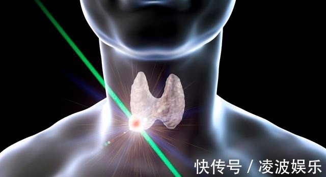 淋巴结|医生癌症都是拖出来的,这7个早期癌症信号要注意