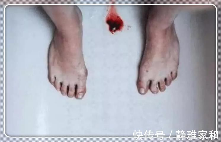 女孩子|女孩子生理期，经常排出“红肉团”？别傻傻不知，多半是这3原因导致