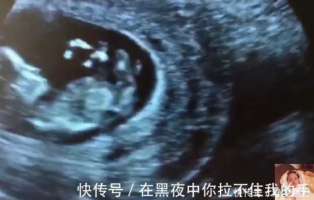 中期孕|除了睡觉,胎儿如何每天在肚子里都干啥宝宝小日子开心到飞起