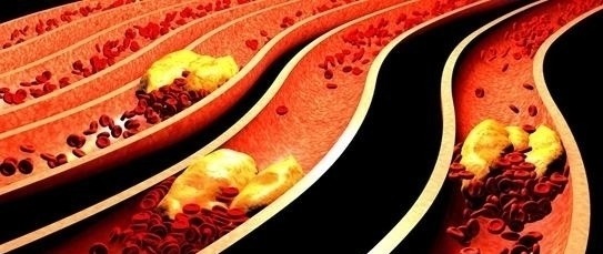 sod|血稠的“救命恩人”遇见了，饭前2口，血栓消失，血液不脏了！