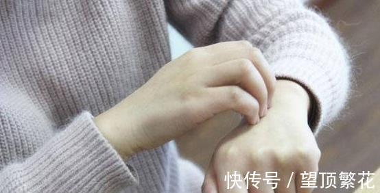 胆汁酸盐|皮肤经常瘙痒,别以为只是皮肤过敏,还要注意肝功能检查,多留意