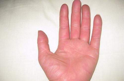  你发现自己|爱出汗的人要注意，身体3处容易出汗，或许不是件好事情