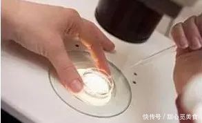 糖尿病人尿泡沫是怎么回事？这篇终于有了科学解释！