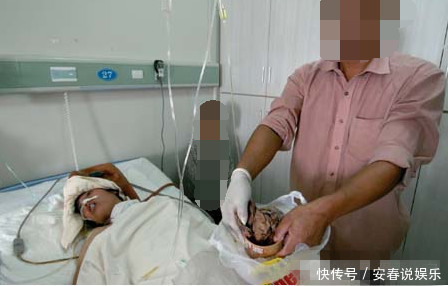 医生|剖腹产后没多久,肚子竟还是大如球,医生再次手术时也惊出一身汗