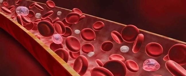 纳豆激酶|血脂高吃什么?降血脂有5个“猛将”!爱吃2种以上,血管感谢你