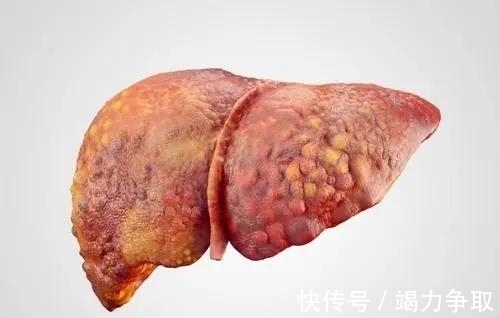 摩尔|好消息:2021新血糖标准已公布,4.0~6.1或不再适用,看一下