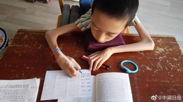 坠积性肺炎|体重18公斤渐冻症新生北航报到:立志做中国的“霍金”