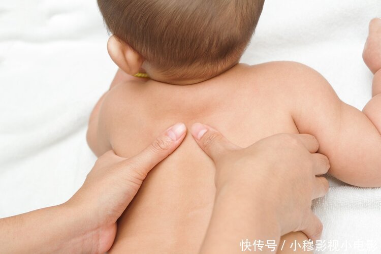 医院|身上无缘无故有淤青,很可能是肝不好!医生提醒:快去医院检查