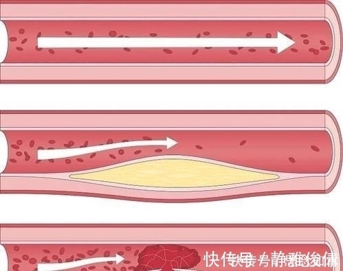 百岁老人|百岁老人长寿经:不是早睡,也不是运动,而是简单4个字!