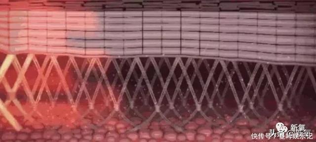 半个娱乐圈女明星脸上都有的这个坑,真的是线雕的锅吗?