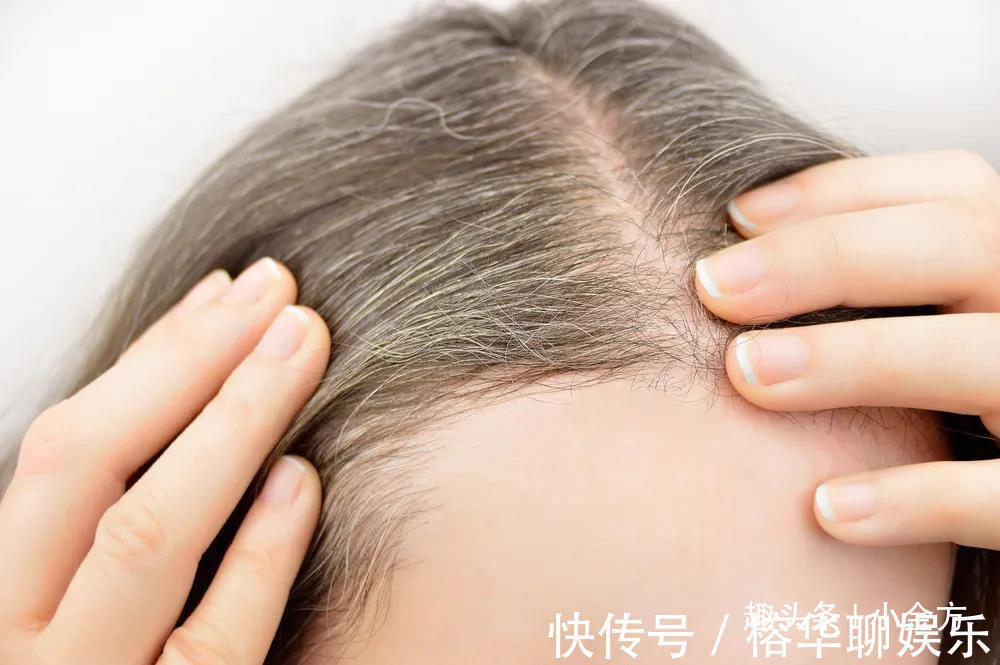 两鬓|两鬓白发、前额白发、后脑白发3个地方有白发，一次讲清楚！