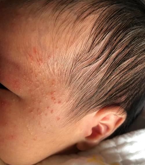 积食|1岁内娃,2种辅食易消化、益脾胃,孩子吃好不积食,养出好体质