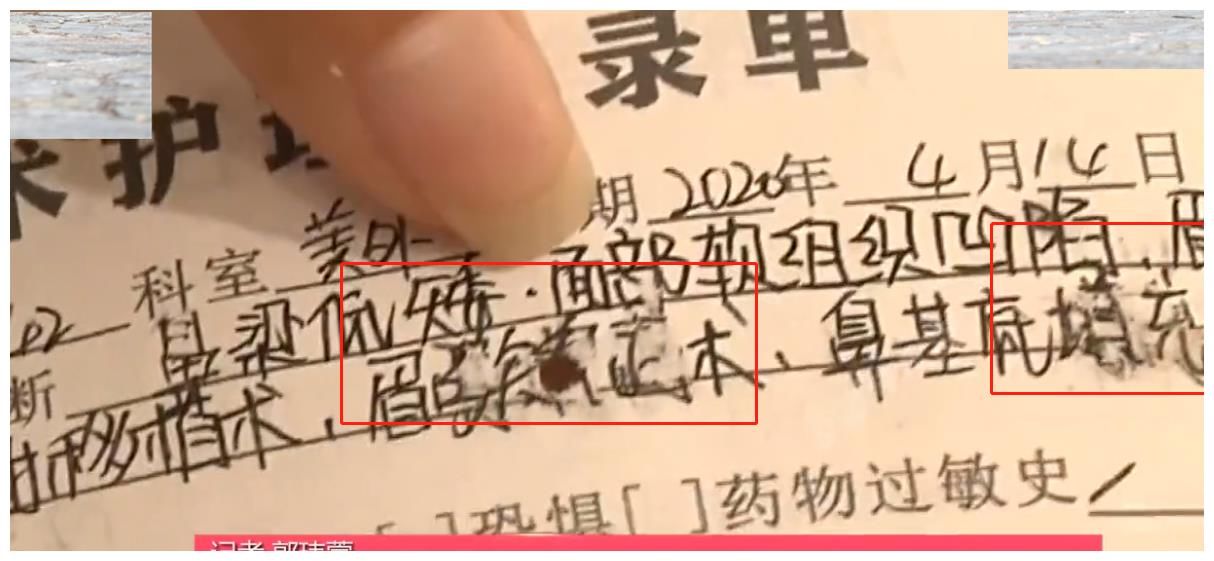 面部吸脂手术|河南女子做面部吸脂失败,笑比哭还难看,商家:赔偿1万我们两清