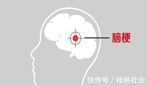 氧气|头晕乏力,可能脑供血不足身体出现异常表现,不能再拖