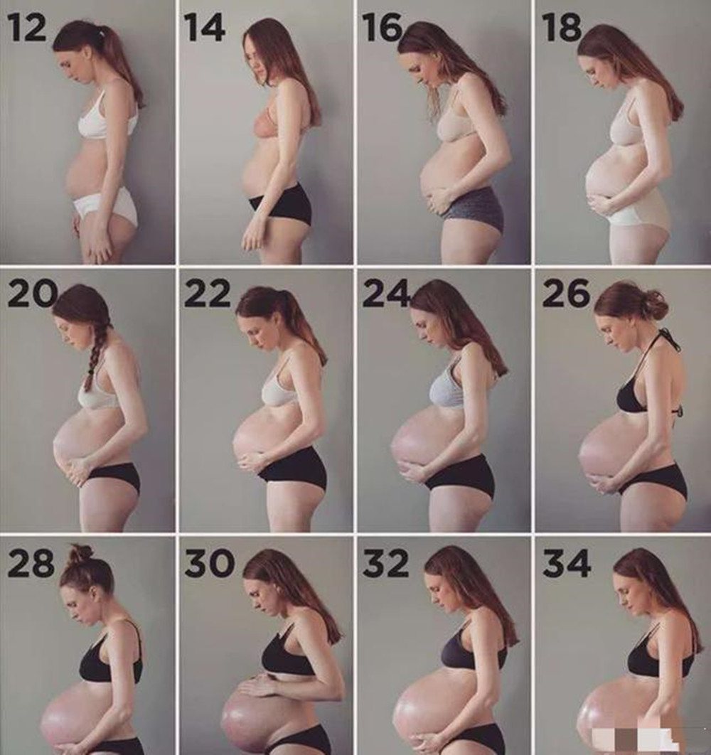 腹直肌|丹麦妈妈怀上三胞胎,产后肚皮却“收不回去”,看完照片感同身受