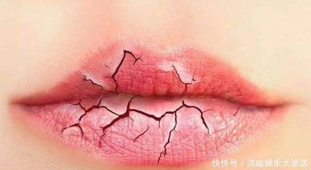 血液黏稠的人，看嘴就知道！若出现3种表现，血管该清理了