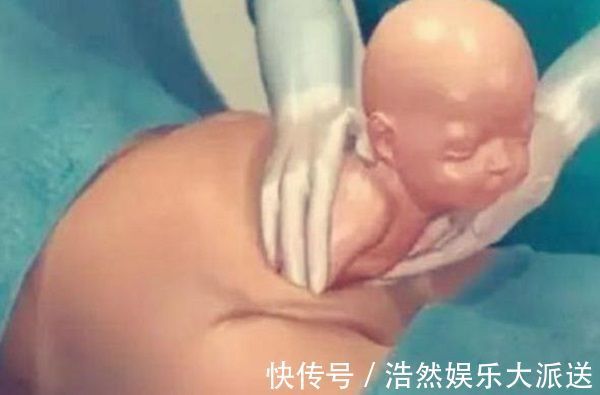 孩子|剖腹产只是“挨一刀”就完事看完手术全过程,忍不住心疼女人
