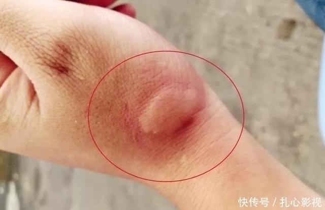 野钓最“狠”的几种动物,看完钓友遭遇才明白,没碰见太幸运啦