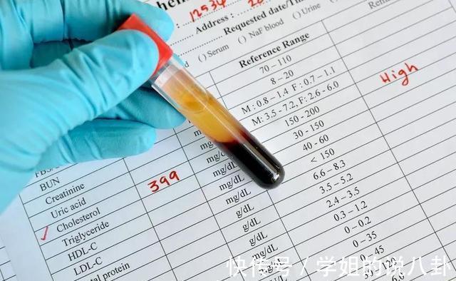 心血管医生|橙子是高血脂的“催化剂”吗?心血管医生:这三种水果,别贪吃