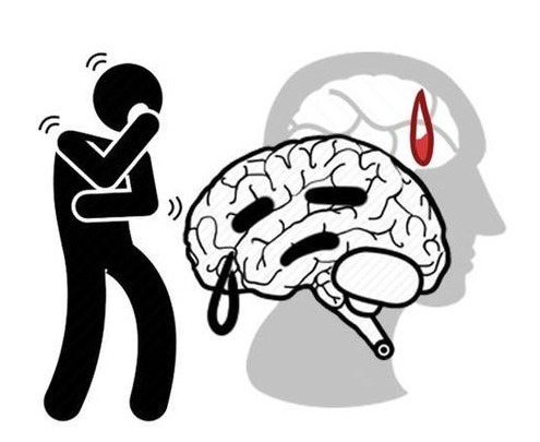 服用降压药|高血压患者出现头痛，是血压不稳吗？可能是这几个原因在“捣鬼”