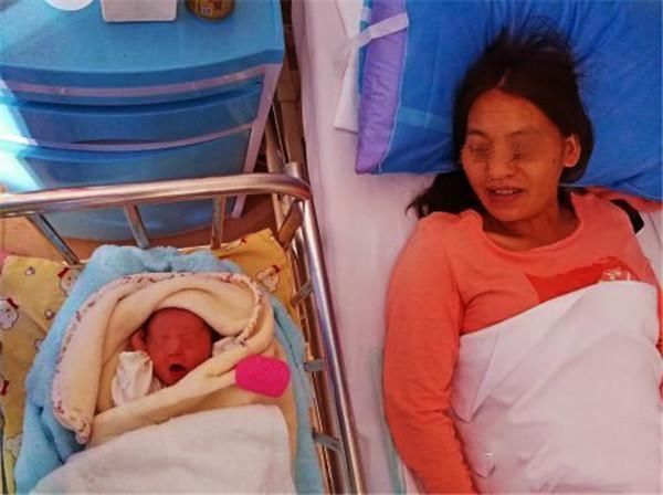 孕妇|孕妇怀孕8个月摔倒大出血,胎儿没有生命体征,剖腹却有意外收获