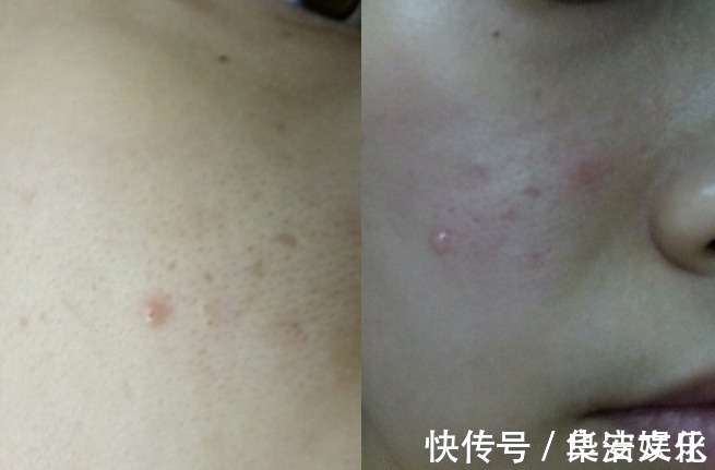 柚子 3个很“伤脸”的护肤习惯,很多女人却很喜欢做,尤其是第2个