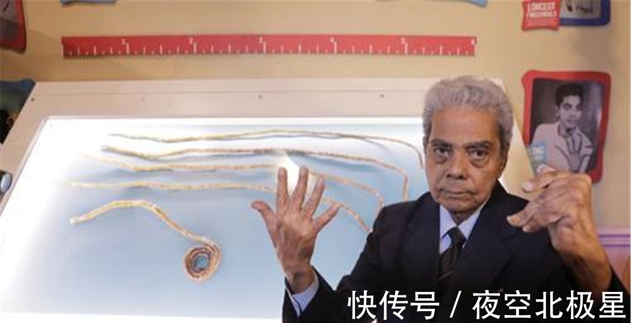 手指|印度大爷留了45年长指甲,剪掉后捐博物馆,不料手指却发生大变化