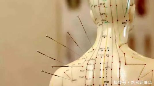 痛风|管用!中医也能有效治疗痛风