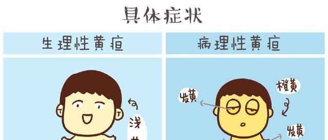 胆红素|宝宝黄疸严重,只因准妈妈在孕期做了这3件事儿,现在改还不晚